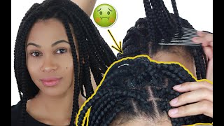 HOW TO CLEAN BOX BRAIDS  REMOVE ALL DANDRUFF amp BUILDUP [upl. by Soigroeg]