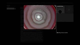 Swarming Motility of Proteus mirabilis  Microbiology [upl. by Rand]