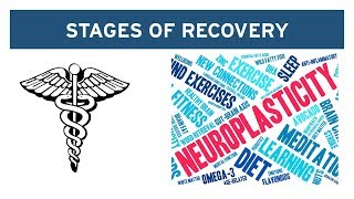 The 2Stage Recovery Process for Vestibular Disorders [upl. by Cassey]