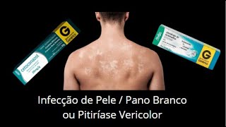 Infecção de pele Pano Branco ou Pitiríase Versicolor [upl. by Mona331]