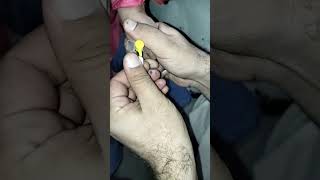 easy I v cannula 24 sizeyoutubecannulayoutuberhospitalnursingnature youtube religion [upl. by Assek]