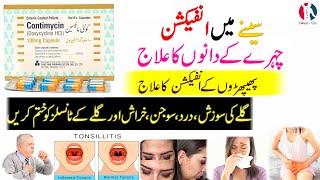 contimycin 100mg  contimycin uses for acne  contimycin capsule uses in urdu  doxycycline capsule [upl. by Adnilram912]