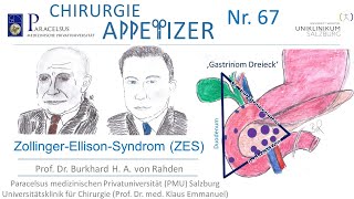 ZollingerEllisonSyndrom CHIRURGIE APPetizer Nr 67 [upl. by Russom]