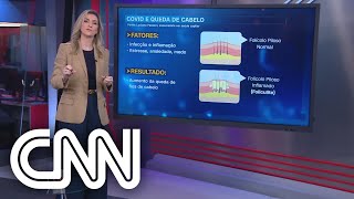 Covid19 pode causar queda de cabelo em 25 dos pacientes infectados  Correspondente Médica [upl. by Terrie]