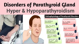 MSN 28 Disorders of Parathyroid Gland Hyper amp Hypoparathyroidism INC Syllabus [upl. by Giuseppe909]