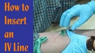 How to Insert an IV Line [upl. by Neddie]