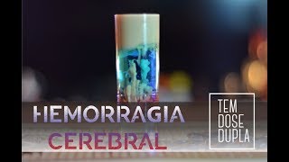 Hemorragia Cerebral SHOT  Como fazer [upl. by Knapp]