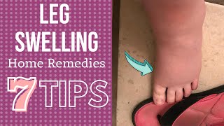 7 Tips for Leg Swelling Treatment at Home Hindi [upl. by Ikiv]