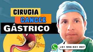 CIRUGÍA DEL CÁNCER DE ESTÓMAGO ¿QUÉ ES LA GASTRECTOMÍA [upl. by Iadam]