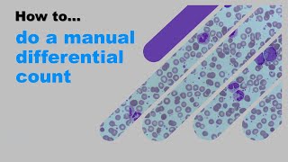 How to do a manual differential count [upl. by Baiss]