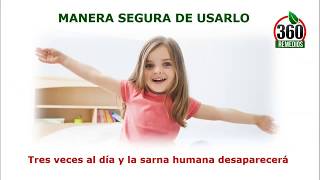 Remedios Caseros Para La Escabiosis En Niños Como Curar La Escabiosis O Sarna Humana [upl. by Hpesoy205]