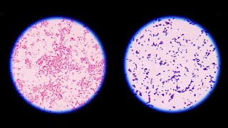 Staining technique in microbiology Gram staining [upl. by Corny]