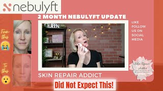 Nebulyft RF 2 Month Update  Before and After Photos [upl. by August620]