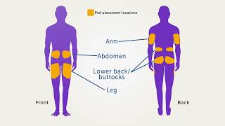 Omnipod® 5 Automated Insulin Delivery System Product Training  Pausing Insulin [upl. by Annairam]