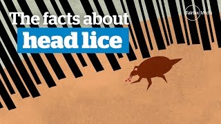 Head lice  the facts [upl. by Ydisahc]