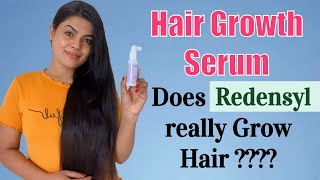 Redensyl Hair Growth Serum 🤨 Does it Really Work [upl. by Fox]