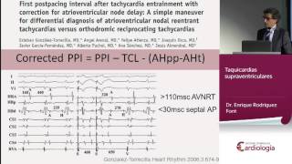 Taquicardias supraventriculares [upl. by Lester895]