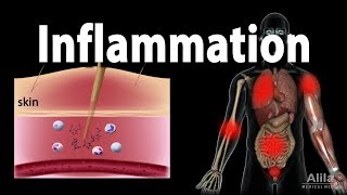 Inflammatory Response Animation [upl. by Durwin277]