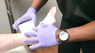 Unna Boot Application by Podiatrist Dr Ejiro Isiorho [upl. by Lean]