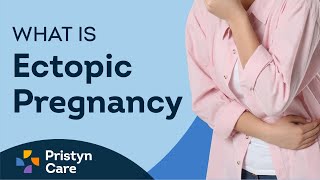 Ectopic Pregnancy  Symptoms Treatment and Complications [upl. by Doughty]