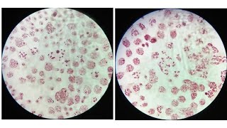 LeptoteneZygotenePachyteneDiplotene amp Diakinesis stages of meiosis with identifying characters [upl. by Bierman480]