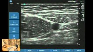 Ultrasound guided obturator and saphenous nerve block workshop [upl. by Free171]