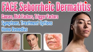 Seborrheic Dermatitis Face Causes Risk amp Trigger Factors Symptoms Treatment Options Home Remedies [upl. by Tanny617]