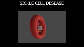 SICKLE CELL DESEASE EXPLAINED [upl. by Eatnoed]