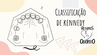 Classificação de Kennedy  Resumos de Odonto [upl. by Repip]