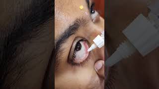 Simple Steps to Apply Eye Ointment eyeawareness eyeclinic mogappair ophthalmologist eyecare [upl. by Mei]