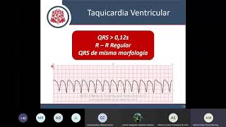 ACLS  Bradiarritmias Taquiarritmias y Paro Cardiorespiratorio [upl. by Sergeant]