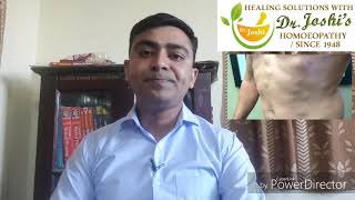 Lipoma Homeopathic Medicine For lipoma [upl. by Nosrettap287]