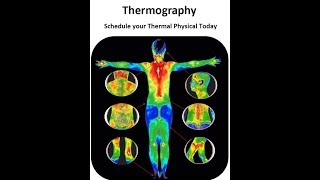 Dr Philip Getson Thermographic Diagnostic Imaging [upl. by Arocal60]