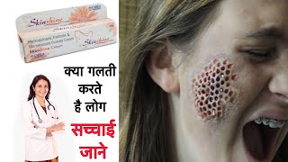 skin shine cream  Side effects  Benefits  how to use  यही सच्चाई किसी ने नहीं बतायी होंगी [upl. by Efram]