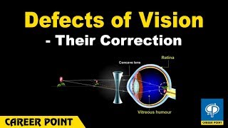 Defects of Vision and Their Correction Myopia And Hypermetropia [upl. by Eberly]