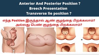 baby position in womb in tamil  fetal position cephalic position of baby baby position in 9 month [upl. by Atnuahsal]