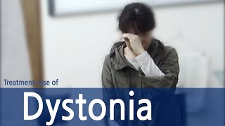 Generalized spasmodic dystonia  Spasmodic Torticollis  Dystonia  사경증 치료사례  근긴장이상증 [upl. by Lazes]