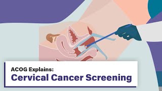 ACOG Explains Cervical Cancer Screening [upl. by Omer]