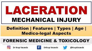 Laceration  Lacerated Wound  Mechanical Injury  Dr Krup Vasavda [upl. by Nims]