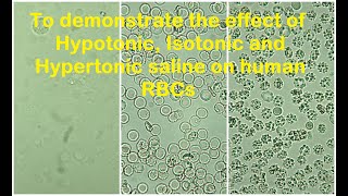 RBCs in Hypotonic Isotonic and Hypertonic solution Practical Lab [upl. by Feliks]