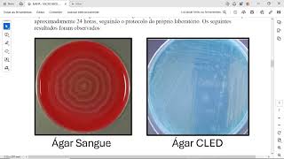 A rotina de um analista clínico no setor de microbiologia é desafiadora Conhecer as técnicas os mi [upl. by Eckblad]