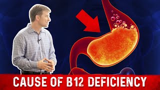 Vitamin B12 Deficiency The most common Cause – Dr Berg [upl. by Dalia]