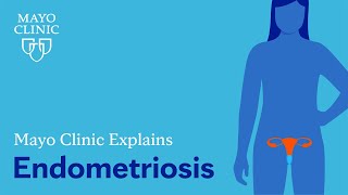 Mayo Clinic Explains Endometriosis [upl. by Selym]