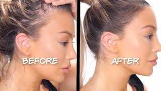 HOW TO FAKE A PERFECT HAIRLINE AND COVER BALD SPOTS  Dilan Sabah [upl. by Asha]