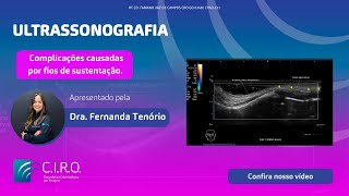 Complicações causadas por fios de sustentação  Caso Clínico com a Dra Fernanda Tenório [upl. by Coster]