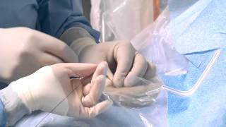 Heart Catheterization Through the Wrist [upl. by Eudo]