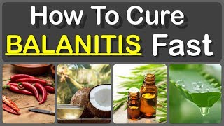 How To Cure Balanitis With Oils Fast And Causes Symptoms And Treatment Of Balanitis [upl. by Attevroc727]