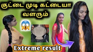 15 நாட்களில் அடர்த்தியான நீளமாக முடி வளர  Thin to thick hair super tips 😍 [upl. by Atilrak989]