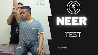 Neer test  shoulder impingement syndrome [upl. by Adriena]