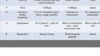 APGAR Score [upl. by Jesher]